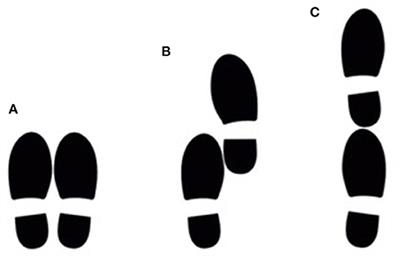 Postural Sway in Parkinson's Disease and Multiple Sclerosis Patients During Tasks With Different Complexity